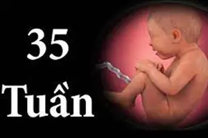 Mang thai 35 tuần là bao nhiêu tháng
