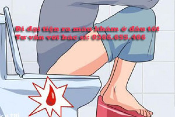 Đi đại tiện ra máu khám ở đâu? 11 Địa chỉ uy tín tại Hà Nội