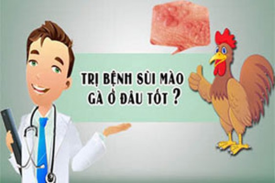 12 Địa chỉ khám chữa bệnh sùi mào gà ở đâu tốt nhất Hà Nội