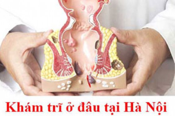 12 địa chỉ phòng khám chữa bệnh trĩ ở đâu tốt nhất Hà Nội