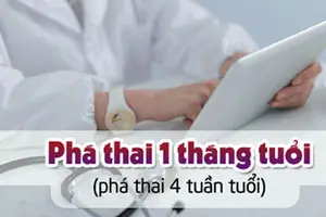Phá thai 1 tháng tuổi (4 tuần) có tội không?