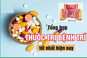 12 Thuốc chữa bệnh trĩ hiệu quả nhất hiện nay tại nhà