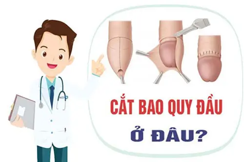 Cắt bao quy đầu ở đâu tốt nhất?