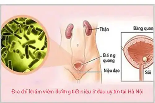 Khám viêm đường tiết niệu ở đâu tốt