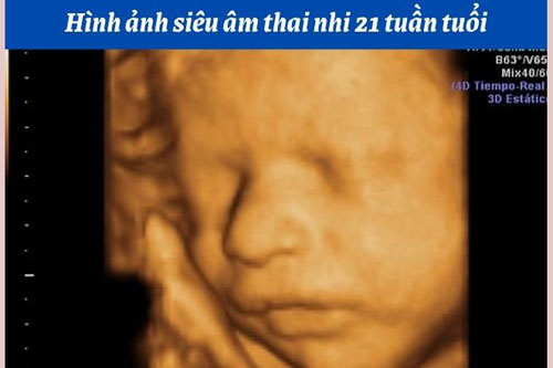 Hình ảnh siêu âm thai nhi 21 tuần tuổi