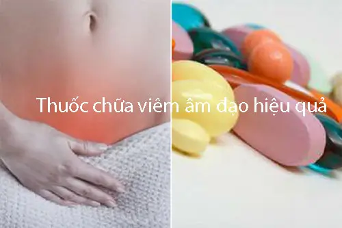Loại thuốc chữa viêm âm đạo hiệu quả